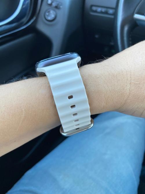 Apple watch strap online discoloured