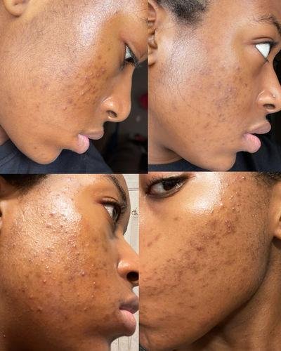 Niacinamide Glow Serum