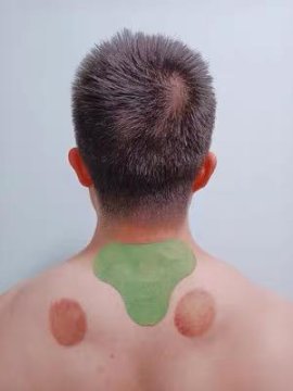 Mrjoint™ Extra Strength Pain Relief Patch for Neck and Shoulder review