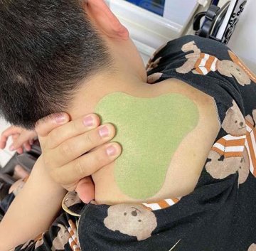 Mrjoint™ Extra Strength Pain Relief Patch for Neck and Shoulder review