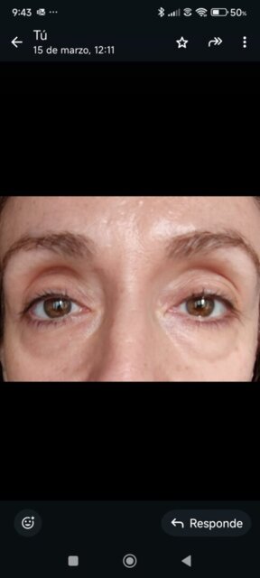 Solución Ojeras y Bolsas |  Contorno de Ojos 15ml