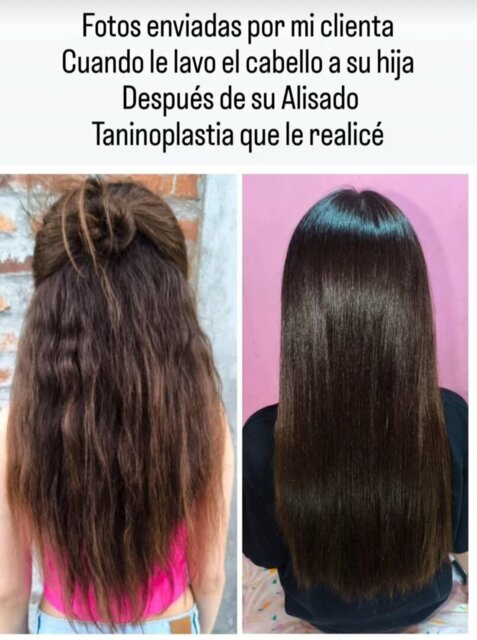 Taninoplastia Diferencia Entre Botox Y Nanoplastia Botox Capilar