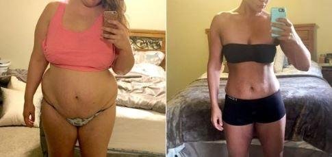 MYMI CurveBelly Wonder Patch
