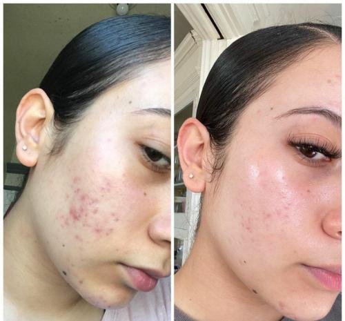 Cosmetific™ GlowLift