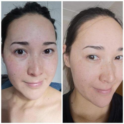 Cosmetific™ GlowLift