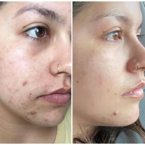 Cosmetific™ GlowLift