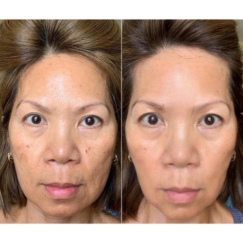 Cosmetific™ GlowLift