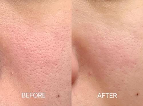 Cosmetific™ GlowLift