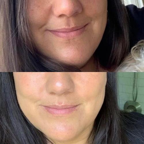 Cosmetific™ GlowLift