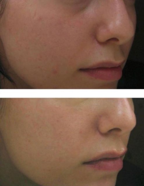 Cosmetific™ GlowLift
