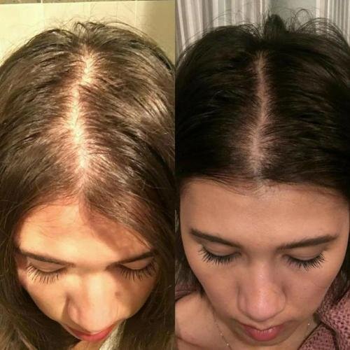 Cosmetific™ GlowHair Mini