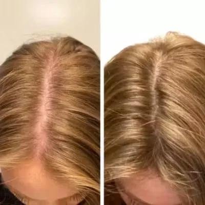 Cosmetific™ GlowHair Mini