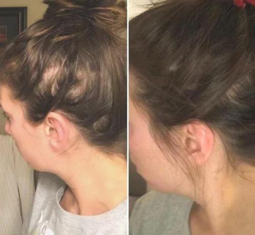 Cosmetific™ GlowHair Mini