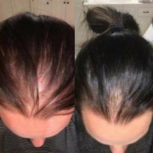 Cosmetific™ GlowHair Mini