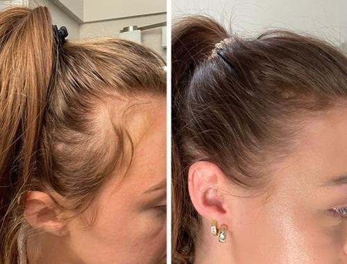 Cosmetific™ GlowHair Mini