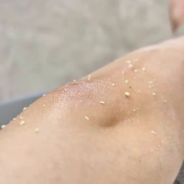 Customer product review photo
