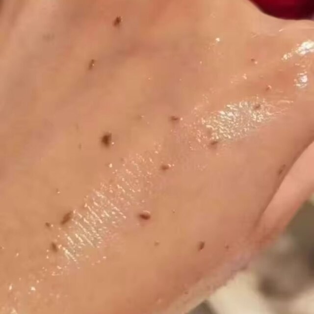 Customer product review photo