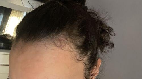 RESERVE HAIR COMPLEX OIL (New Edition)