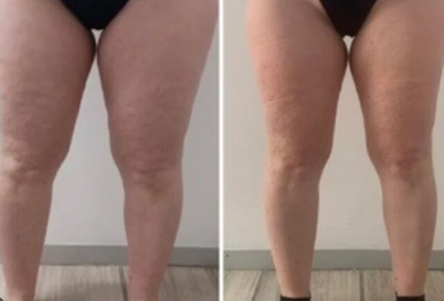 Customer before and after review
