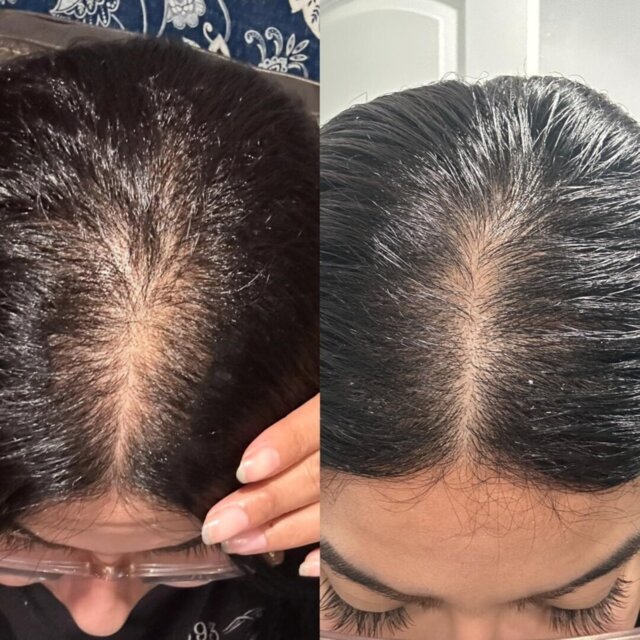 GrowthlyCo Pumpkin Seed Oil Softgels image Pumpkin Seed Oil Softgels