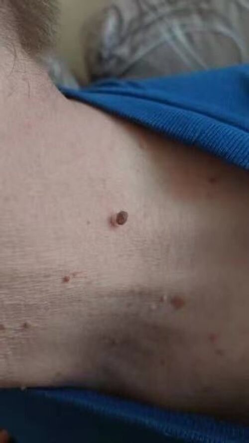 Result