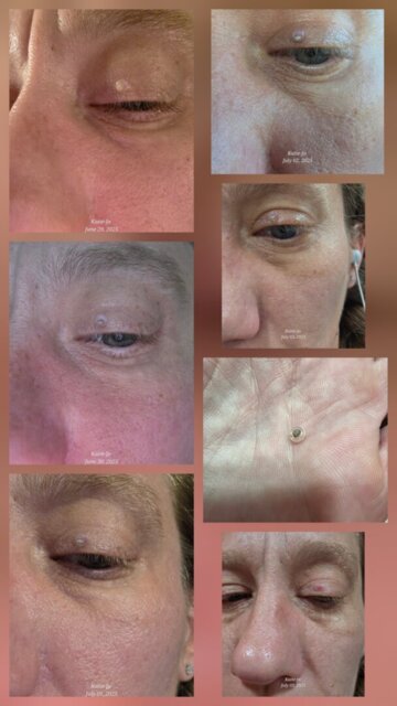 Customer result