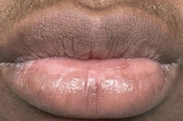 Pack Lèvres Roses PinkLips review