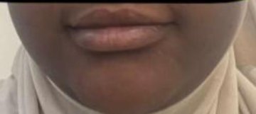 Pack Lèvres Roses PinkLips review
