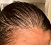ActiveHair™ Hair Growth Spray , Ginger Hair Spray For Hair Growth