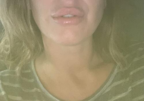 PoutPerfect | Lip Plumper