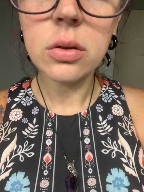 PoutPerfect | Lip Plumper