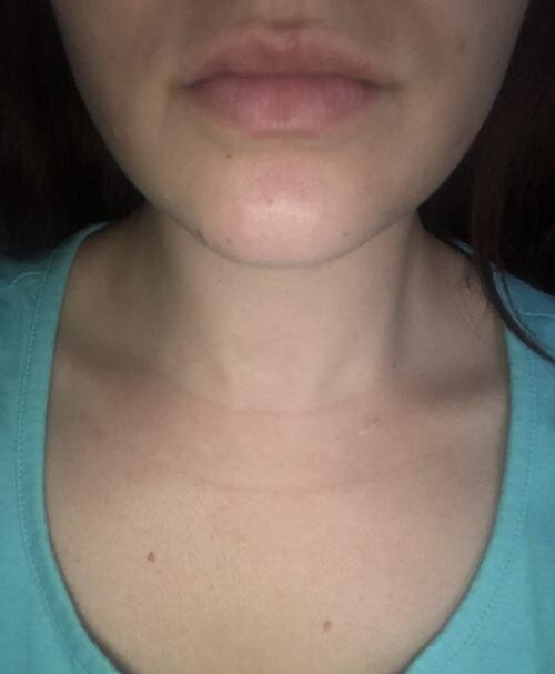 PoutPerfect | Lip Plumper