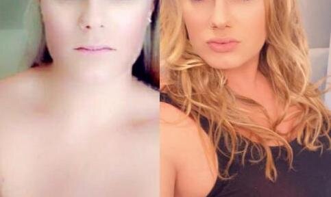 PoutPerfect | Lip Plumper