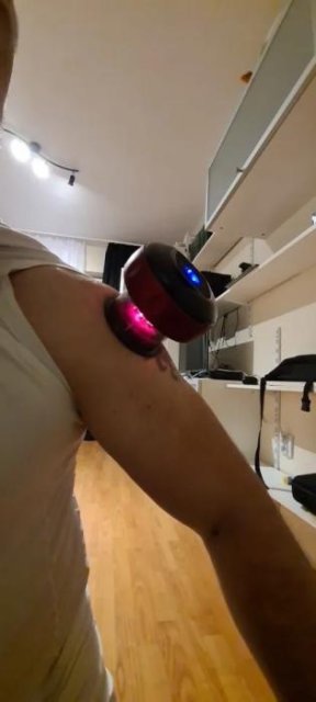 Electric Vacuum Cupping Massage: Next-Gen Wellness & Recovery Solutions