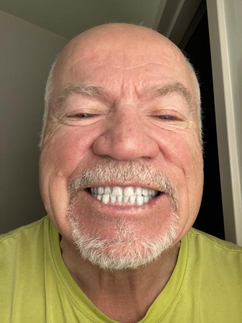 Purple Toothpaste
