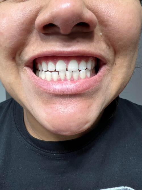 Purple Toothpaste
