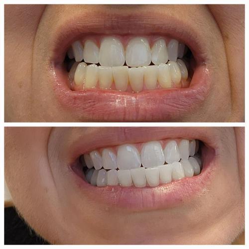 Purple Toothpaste