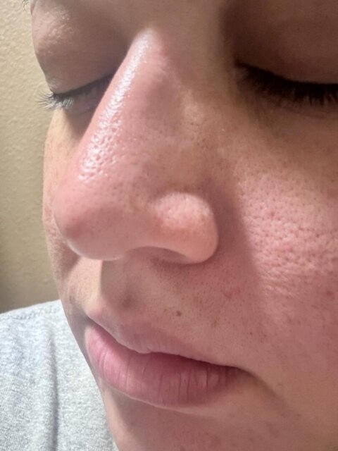 Dr.Melaxin Rice Peel Glow Serum Ampoule